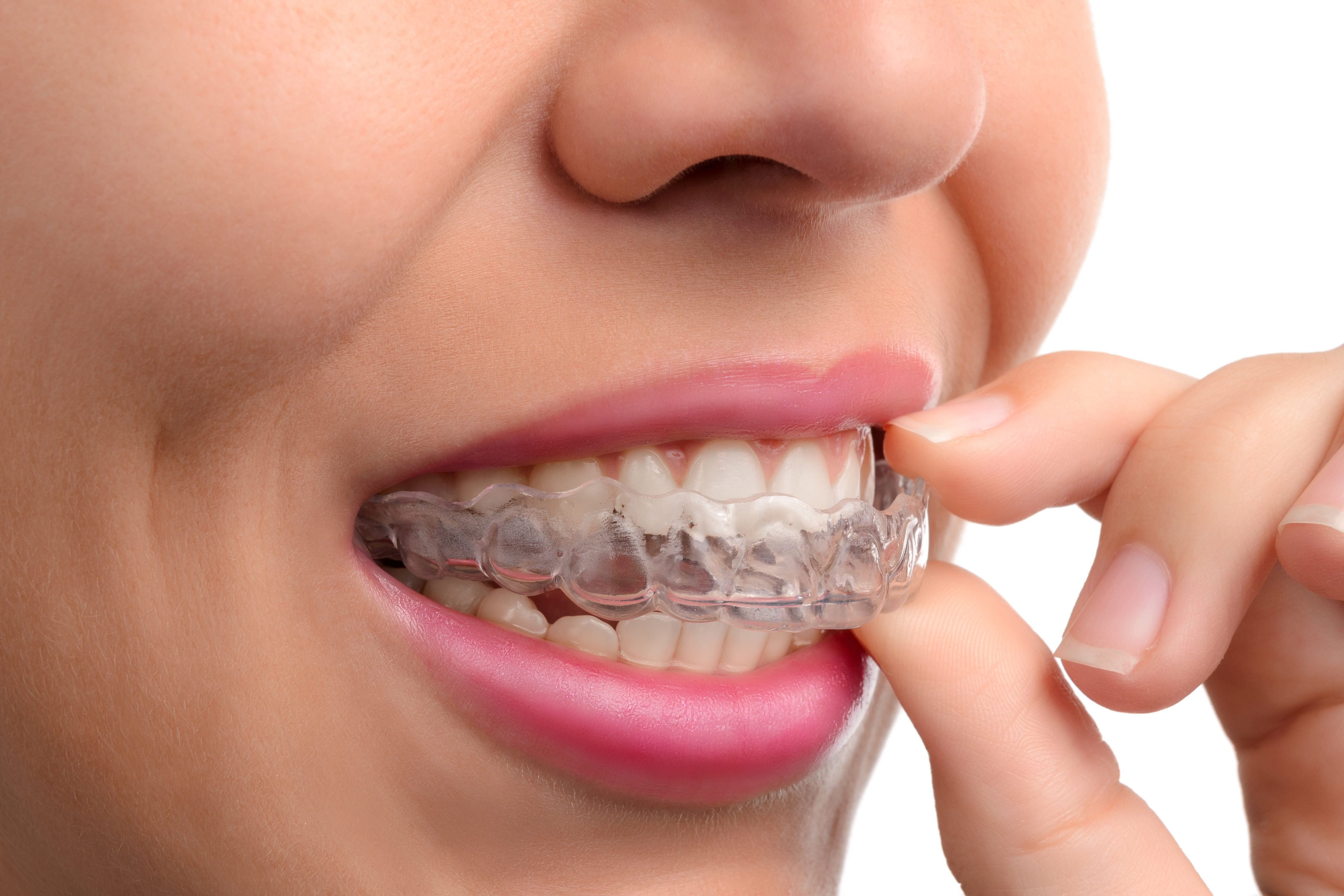 tmj guard bruxism mouth night invisalign orthodontics kansas teeth treatments surgery jaw dental chewing
